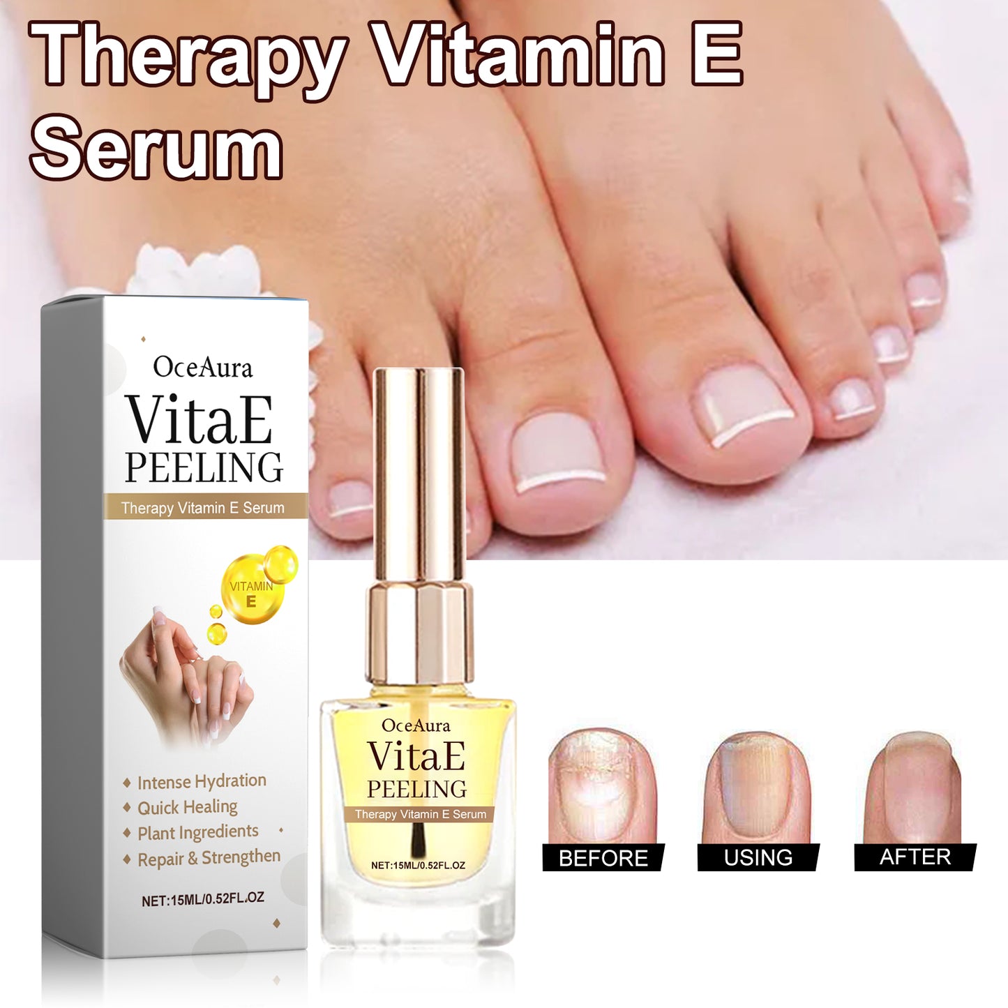 Therapy Vitamin E Serum, Hand And Foot Nail Repair Bright Nail Grey Nail Soft Nail Embedded Nail Care Essence