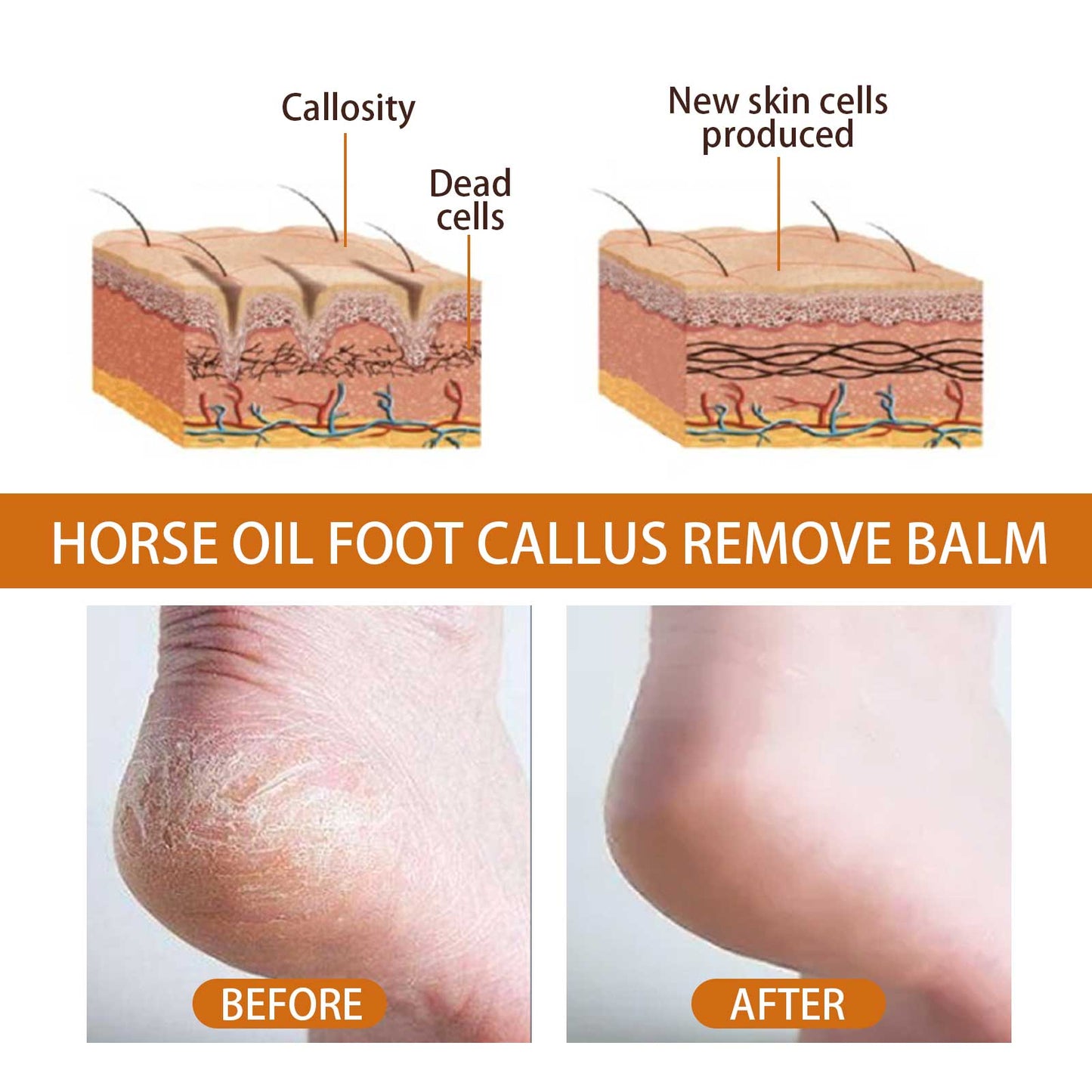 Horse Oil Foot Care Cream, Repair Heel Peeling Anti-Cracking Moisturizing Foot Care Cream