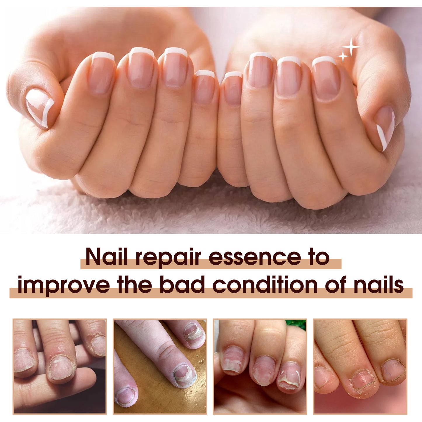 Therapy Vitamin E Serum, Hand And Foot Nail Repair Bright Nail Grey Nail Soft Nail Embedded Nail Care Essence