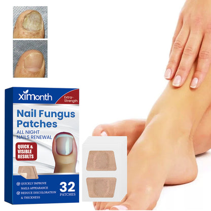 Nail Fungus Patches, Repair Hand And Foot Nails Inlaid Nail Thickening Gray Nail Brightening Nail Patch