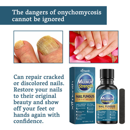 Nail Fungus Treatment, Nail Thickening Of Embedded Light Mail This Soft Armour Brothers Nails Detailer