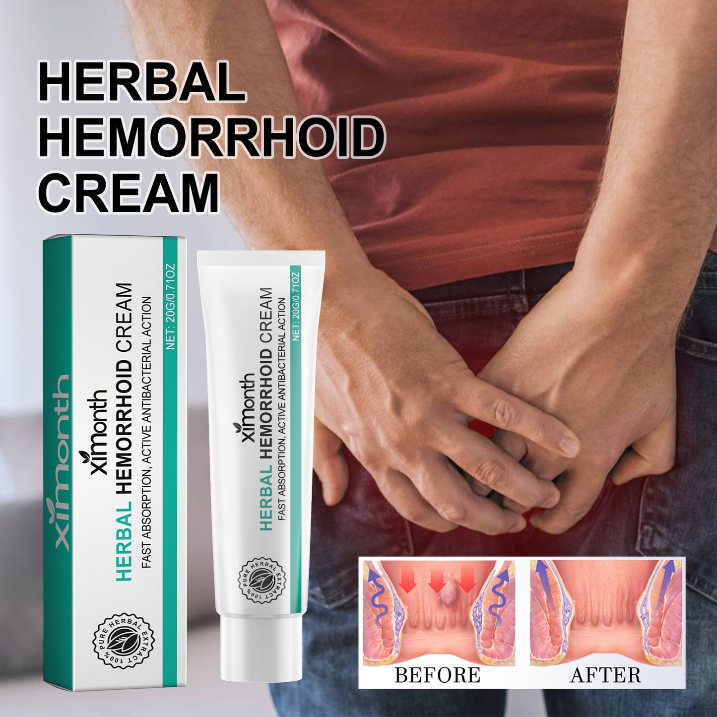 Herbal Hemorrhoid Cream, Relieve Perianal Itching Pain Discomfort Xiaozhi Xiaorou Ball Body Care Hemorrhoids Cream